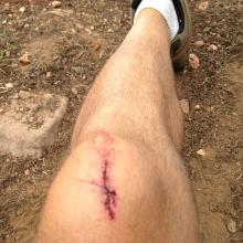 295 Blowdowns, missed one